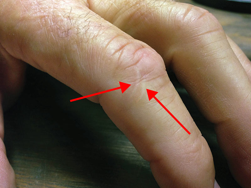 The Squirrel That Bit Me Larry's Short Stories